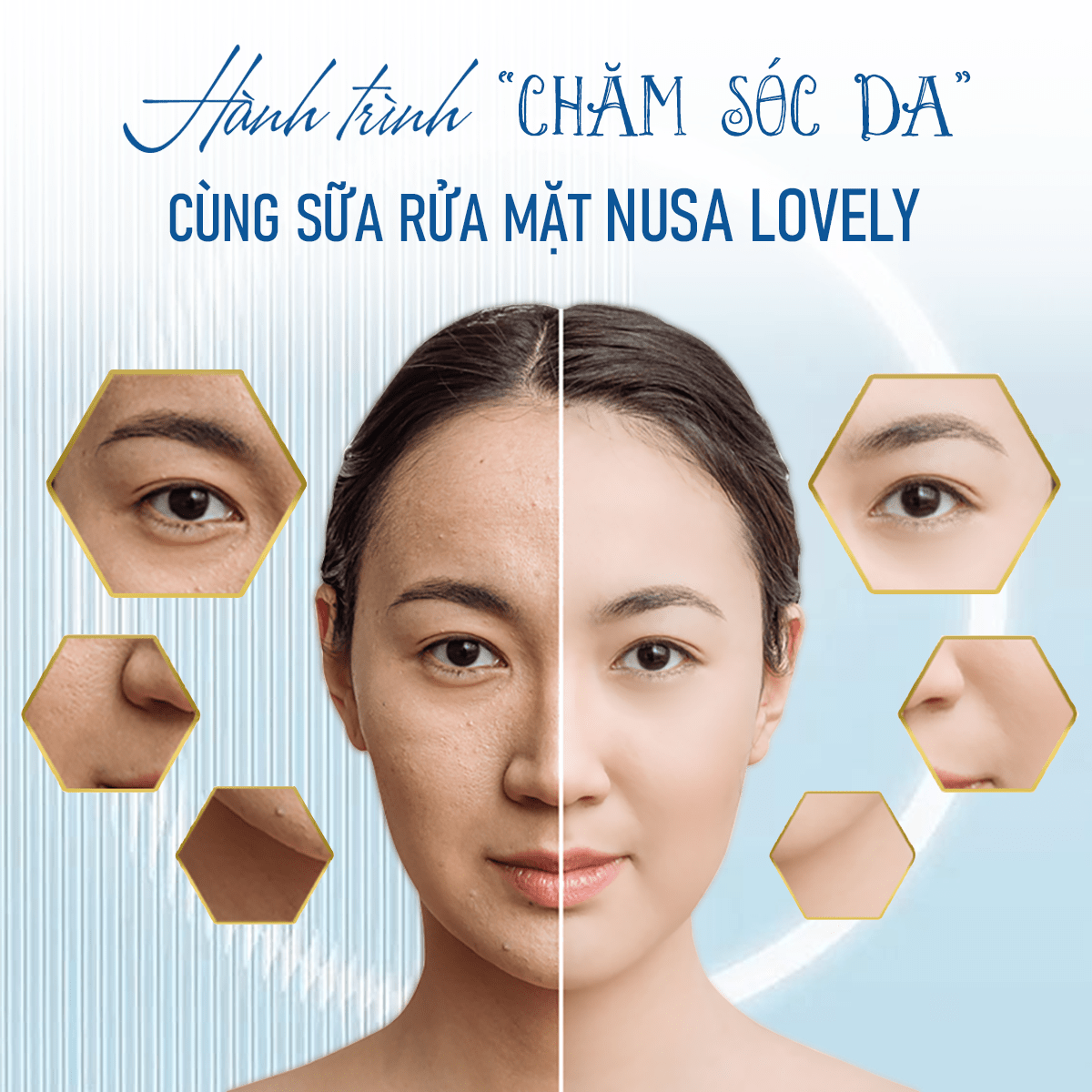 Sữa Rửa Mặt NUSA Chuyên Trị Các Loại Da Mụn, Da Dầu (150ml)