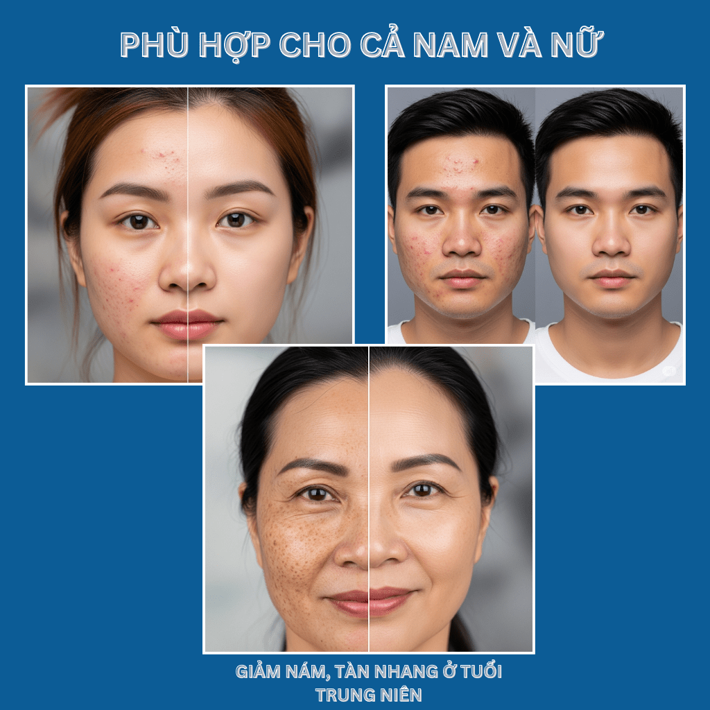 Sữa Rửa Mặt NUSA Dành Cho Da Dầu Mụn  (150ml)....